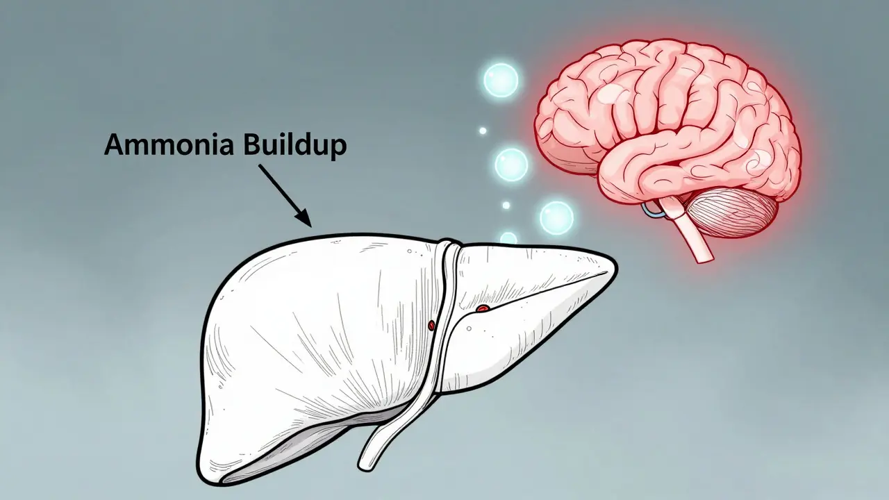 Hepatic Encephalopathy: Understanding Confusion, Lactulose, and Prevention